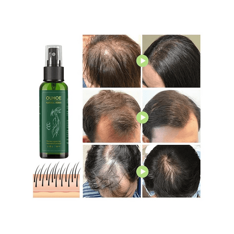 Spray de jengibre para en crecimiento del cabello