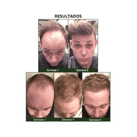 Spray de jengibre para en crecimiento del cabello